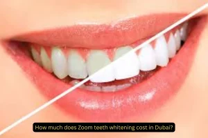 Zoom teeth whitening cost in Dubai