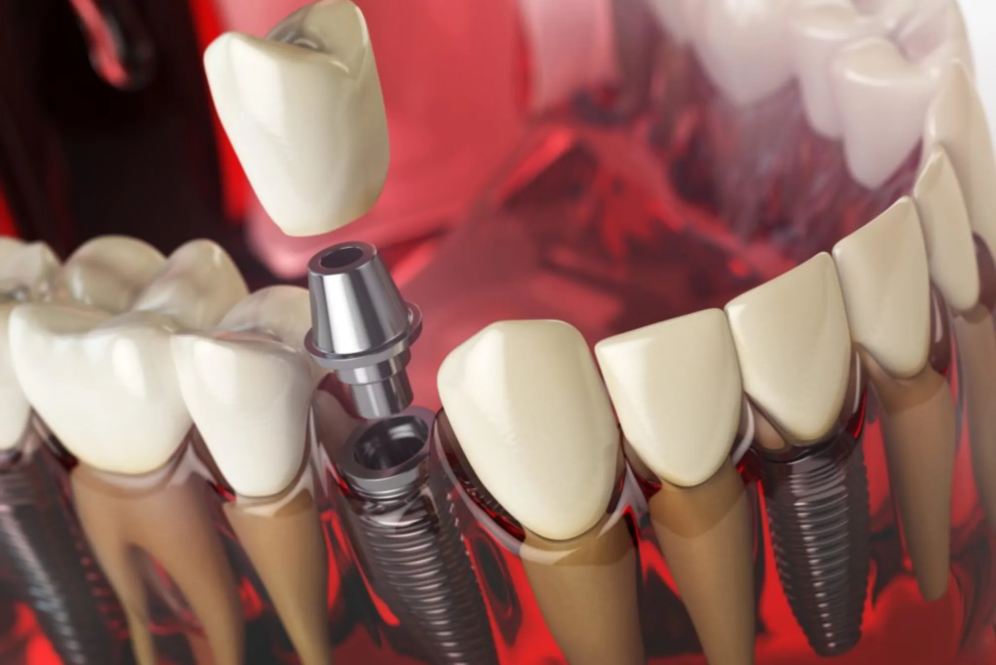 Finding the Best Cosmetic Dental Clinic in Dubai